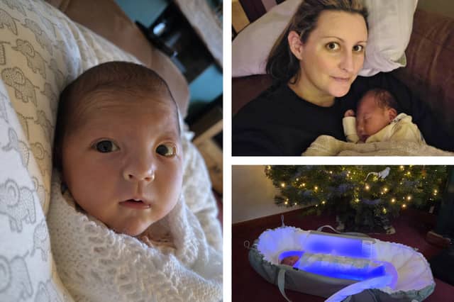 Alicia Hardie, whose daughter Cora was born three weeks early on Christmas Eve has welcomed a new service after newborn babies with jaundice can now be treated at home in a special sleeping bag-style garment
