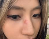 Yumin was punched in nose on Princes Street Gardens on Friday