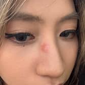 Yumin was punched in nose on Princes Street Gardens on Friday