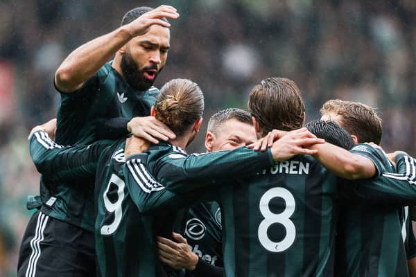 Celtic have been hit with a hammer injury blow ahead of their Premier Sports Cup against Dundee United this weekend. Cr: SNS Group.