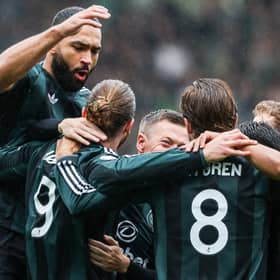 Celtic have been hit with a hammer injury blow ahead of their Premier Sports Cup against Dundee United this weekend. Cr: SNS Group.