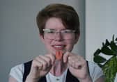 Dr Imogen Brooks, believed to be the first person in the UK to get a bespoke artificial tongue, poses with her spare (Picture: Yui Mok)
