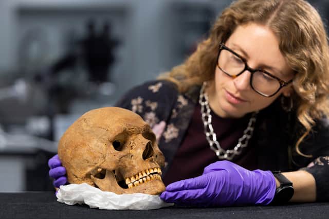 Dr Jess Thompson examines the skull of a man from Roman Scotland