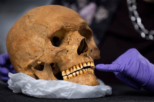 Dr Jess Thompson examines the skull of a man from Roman Scotland