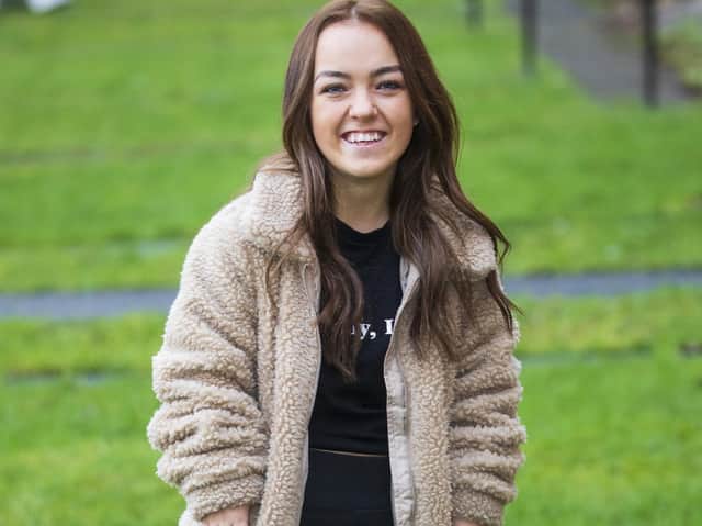 The psychology student said she can't leave the house without people staring - and strangers even take photos of her without her permission.