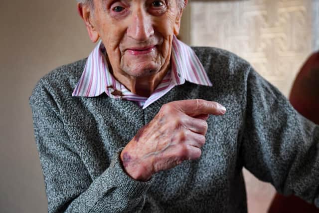 John Cox, who has been targeted by burglars twice in four months, suffered cuts and bruises to his left arm after an intruder attempted to force their way into his home in Lincoln on Tuesday.