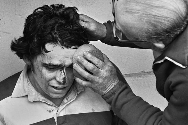 Wigan scrum-half Jimmy Nulty receives the magic sponge treatment after a bang against Swinton in the Premiership Trophy 1st round match at Central Park on Saturday 26th of April 1975.
Wigan won 19-17.