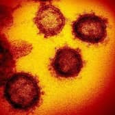 The number of cases of coronavirus in Scotland has risen to three. Image: AP