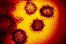 The number of cases of coronavirus in Scotland has risen to three. Image: AP