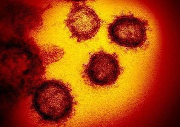 The number of cases of coronavirus in Scotland has risen to three. Image: AP
