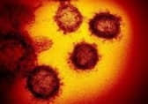 The number of cases of coronavirus in Scotland has risen to three. Image: AP