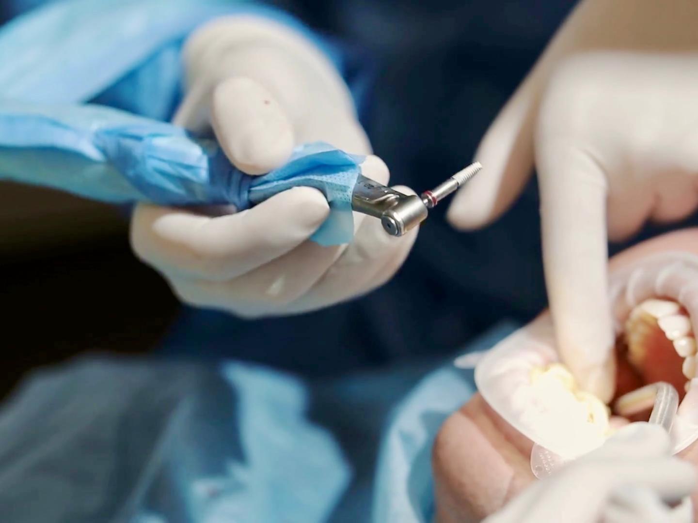 Learn to love your smile again with dental implants | The ... Learn to love your smile again with dental implants | The ...