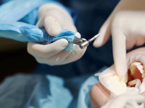 Dental implants needn't be a painful, drawn-out process.