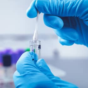 Diagnoses for gonorrhoea and syphilis hit record highs in 2022 in new findings from the UK Health Security Agency.