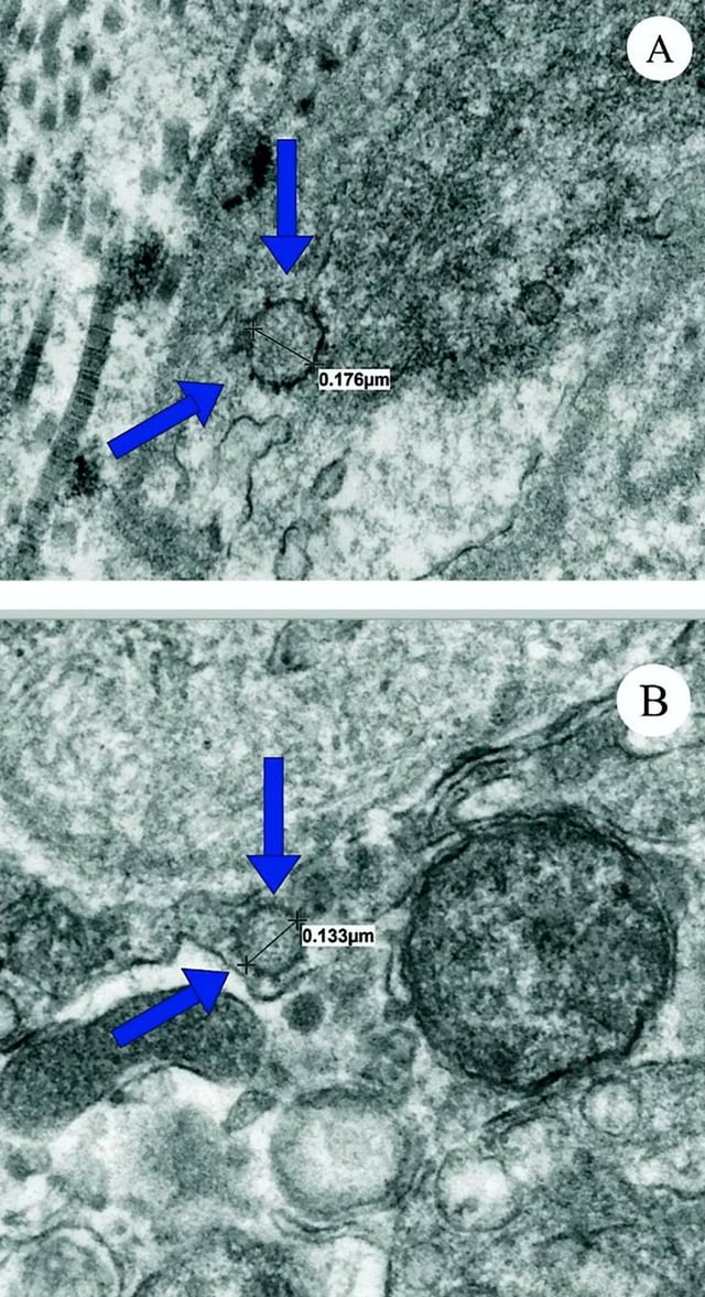 ‘Coronavirus can cause men to become impotent’, scientists from University of Miami find ‘Coronavirus can cause men to become impotent’, scientists from University of Miami find