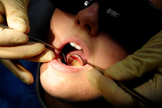 Research has found that some Scots are travelling to India to be seen by a dentist. PIC: PA.