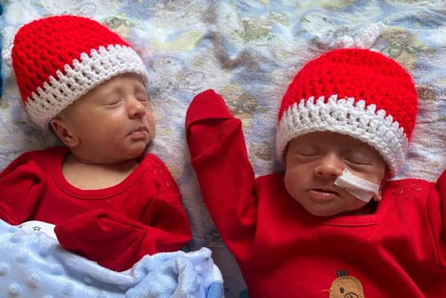Identical twins Theo and Olly Johnston  twin to twin transfusion syndrome (TTTS).