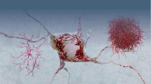 Tau is a small protein with a short name but a huge reputation because of its association with multiple brain diseases