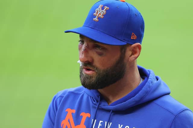 Kevin Pillar of the New York Mets was left with heavy facial bruising after being hit by the pitch. Picture: Kevin C. Cox/Getty Images