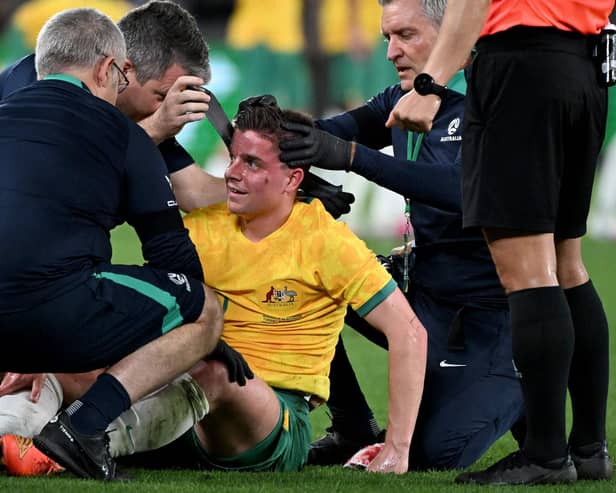 Hearts midfielder Cameron Devlin receives treatment for a blow to the head during Australia's defeat by Ecuador.