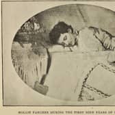 A Fasting Girl: Mollie Fancher, of Brooklyn, became known the world over for her ablity to go without food for long periods of time with her case - and others - linked to miracle making and religious sanctity. PIC: CC.