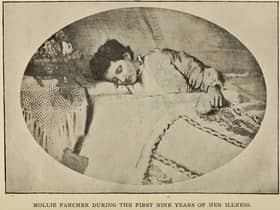 A Fasting Girl: Mollie Fancher, of Brooklyn, became known the world over for her ablity to go without food for long periods of time with her case - and others - linked to miracle making and religious sanctity. PIC: CC.