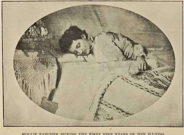 A Fasting Girl: Mollie Fancher, of Brooklyn, became known the world over for her ablity to go without food for long periods of time with her case - and others - linked to miracle making and religious sanctity. PIC: CC.