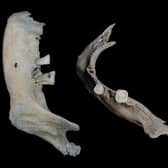 An x-ray of the jawbone of The Elder with her teeth now giving fascinating insight into the life of the woman who lived in Orkney around 1,800 years ago. PIC: UHI Archaeology Institute.