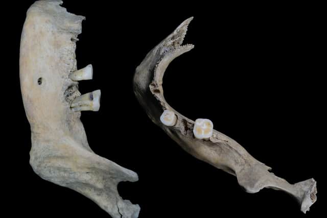 An x-ray of the jawbone of The Elder with her teeth now giving fascinating insight into the life of the woman who lived in Orkney around 1,800 years ago. PIC: UHI Archaeology Institute.