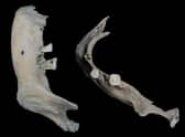 An x-ray of the jawbone of The Elder with her teeth now giving fascinating insight into the life of the woman who lived in Orkney around 1,800 years ago. PIC: UHI Archaeology Institute.