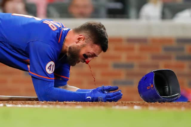 Kevin Pillar of the New York Mets takes a moment as his nose bleeds after being hit by a pitch against the Atlanta Braves. Picture: Todd Kirkland/Getty Images