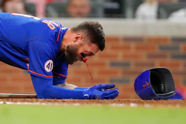 Kevin Pillar of the New York Mets takes a moment as his nose bleeds after being hit by a pitch against the Atlanta Braves. Picture: Todd Kirkland/Getty Images