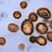 Coronavirus has now killed 35 people in the UK. PIC: Getty/AFP.
