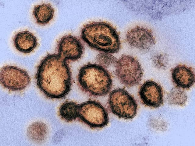 Coronavirus has now killed 35 people in the UK. PIC: Getty/AFP.