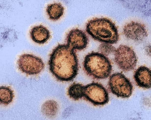 Coronavirus has now killed 35 people in the UK. PIC: Getty/AFP.