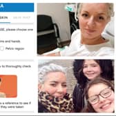 Primary school teacher Adele Hughes was diagnosed with melanoma a month before her 40th birthday and then successfully treated for the disease, and has praised a new smartphone app in development