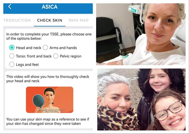 Primary school teacher Adele Hughes was diagnosed with melanoma a month before her 40th birthday and then successfully treated for the disease, and has praised a new smartphone app in development