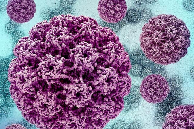 HPV_virus