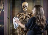 The current major exhibition at the National Museum of Scotland explores the history of anatomical study. Picture: Neil Hanna