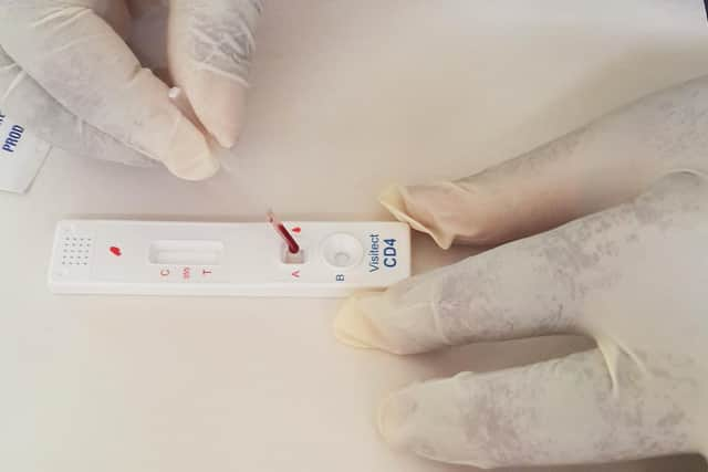 Omega Diagnostics' Visitect CD4 product enables people with HIV to test their immune systems.