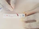 Omega Diagnostics' Visitect CD4 product enables people with HIV to test their immune systems.