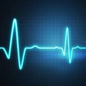 The British Heart Foundation has said fewer than half of people see a cardiologist within 12 weeks