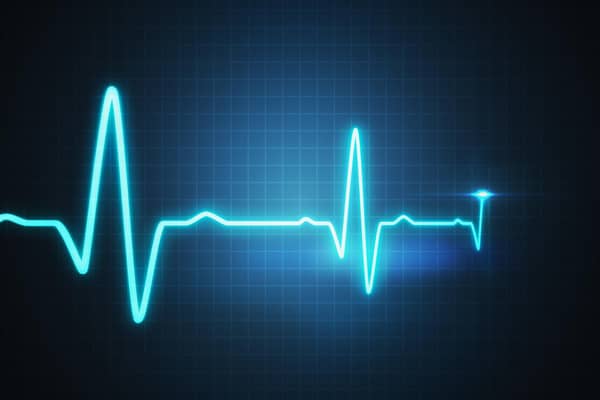 The British Heart Foundation has said fewer than half of people see a cardiologist within 12 weeks