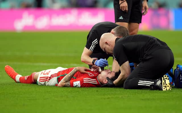 Wales' Neco Williams receiving treatment for an injury. Robert Page has defended the decision to let Williams play on after the Wales full-back suffered a head injury against England at the World Cup. Issue date: Wednesday November 30, 2022.