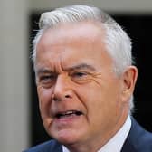 BBC journalist Huw Edwards is being treated in hospital