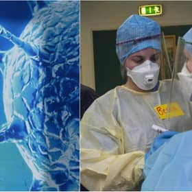 Surgeons are concerned about the impact of a patient backlog due to Covid.