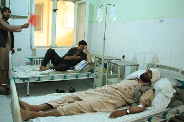 Wounded people receive treatments at a hospital following an attack by masked gunmen which killed 10 people working for the HALO Trust mine-clearing organisation, at Pol-e-Khomri in Baghlan Province on June 9, 2021 (Photo by -/AFP via Getty Images).