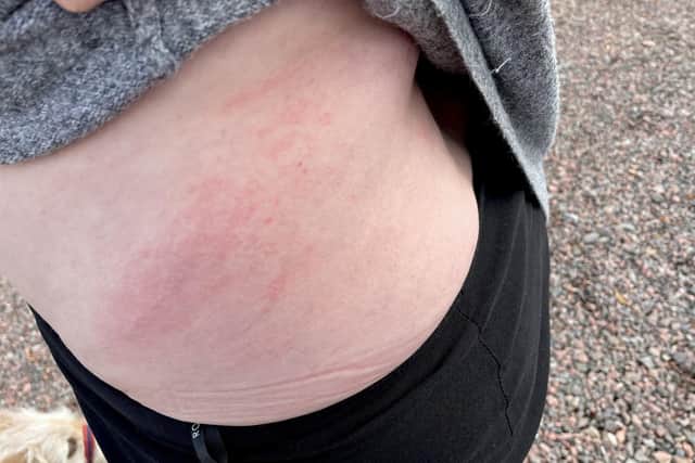 The photographer was left with a mark, but believes she got off lucky.