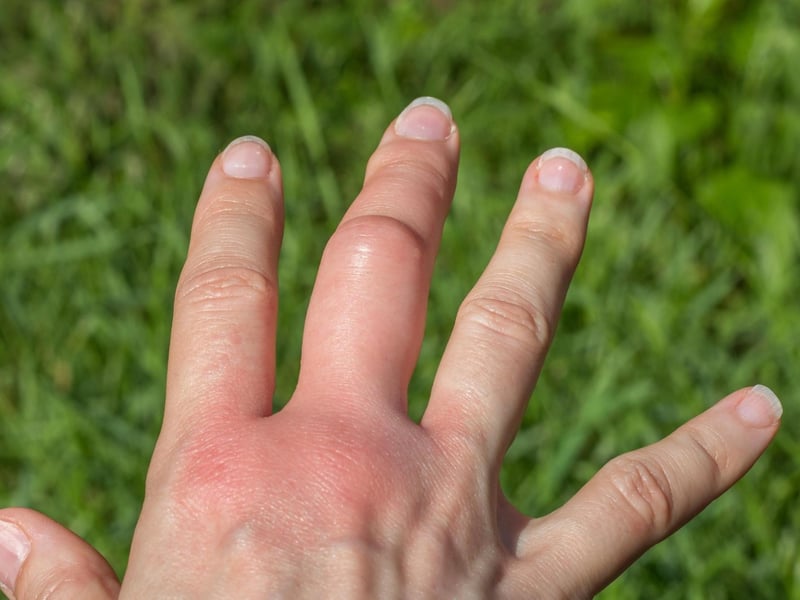 If you’ve ever experienced throbbing pain like a sore finger then you know what the word “goupin” means i.e., throbbing with pain.