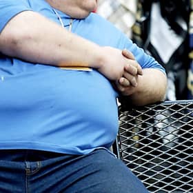 More than a quarter of Scots believe people who are overweight or obese “have only themselves to blame”